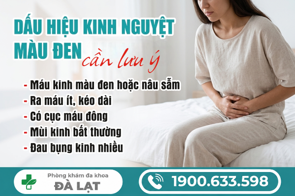 Hình ảnh minh họa
